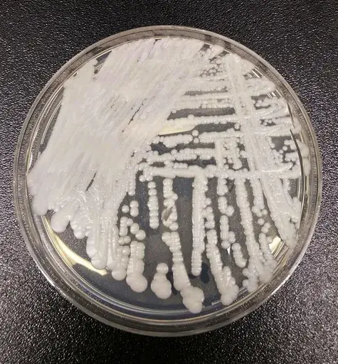 This undated photo made available by the Centers for Disease Control and Prevention shows a strain of Candida auris cultured in a petri dish at a CDC laboratory. In a CDC paper published by the Annals of Internal Medicine on Monday, March 20, 2023, U.S. cases of the dangerous fungus tripled over just three years, and more than half of states have now reported it. (Shawn Lockhart/Centers for Disease Control and Prevention via AP, File)
